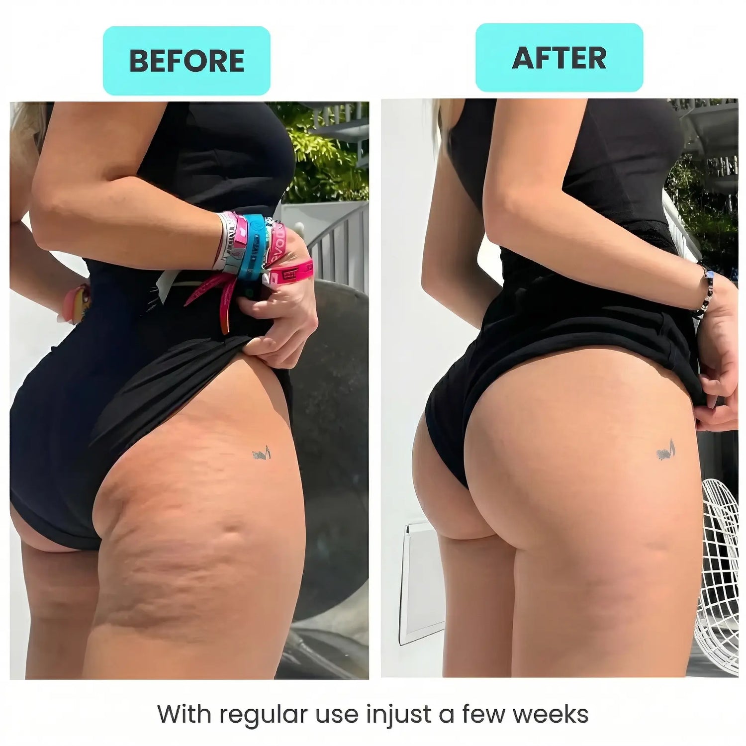 RPM Sculpt Roller - Anti-Cellulite